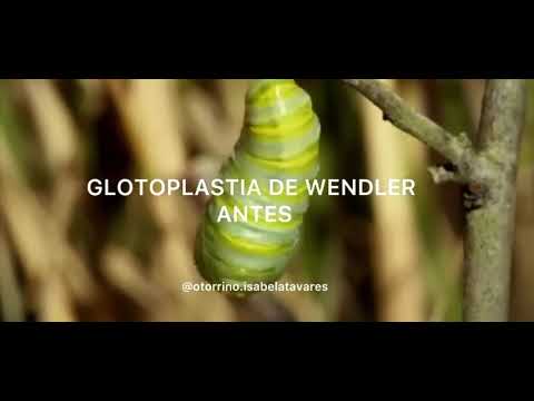 Vídeo