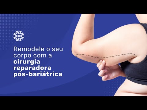 Vídeo