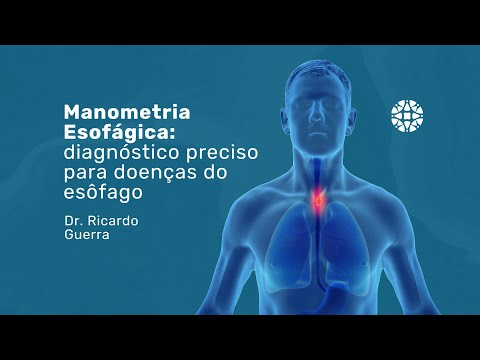 Vídeo