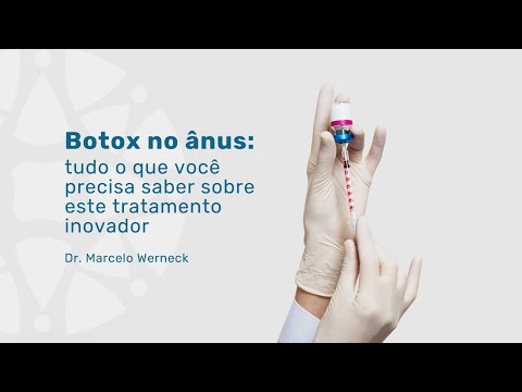 Vídeo