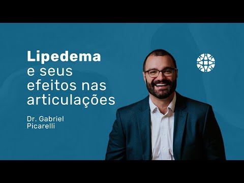 Vídeo