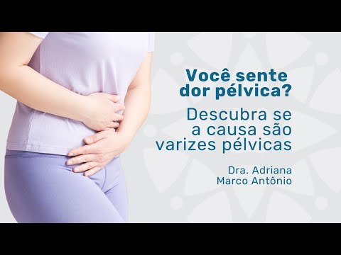 Vídeo