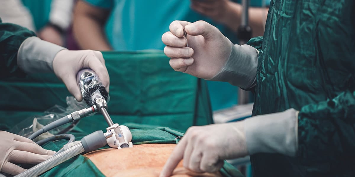 Cirurgia Robótica para a Bariátrica com o Dr. Rodrigo Barbosa 3 Cirurgiões bariátricos fazendo cirurgia bariátrica laparoscópica - site Dr. Rodrigo Barbosa cirurgião bariátrico e gastrocirurgião São Paulo - SP