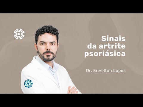 Vídeo