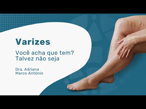 Vídeo