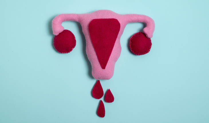 mioma uterino