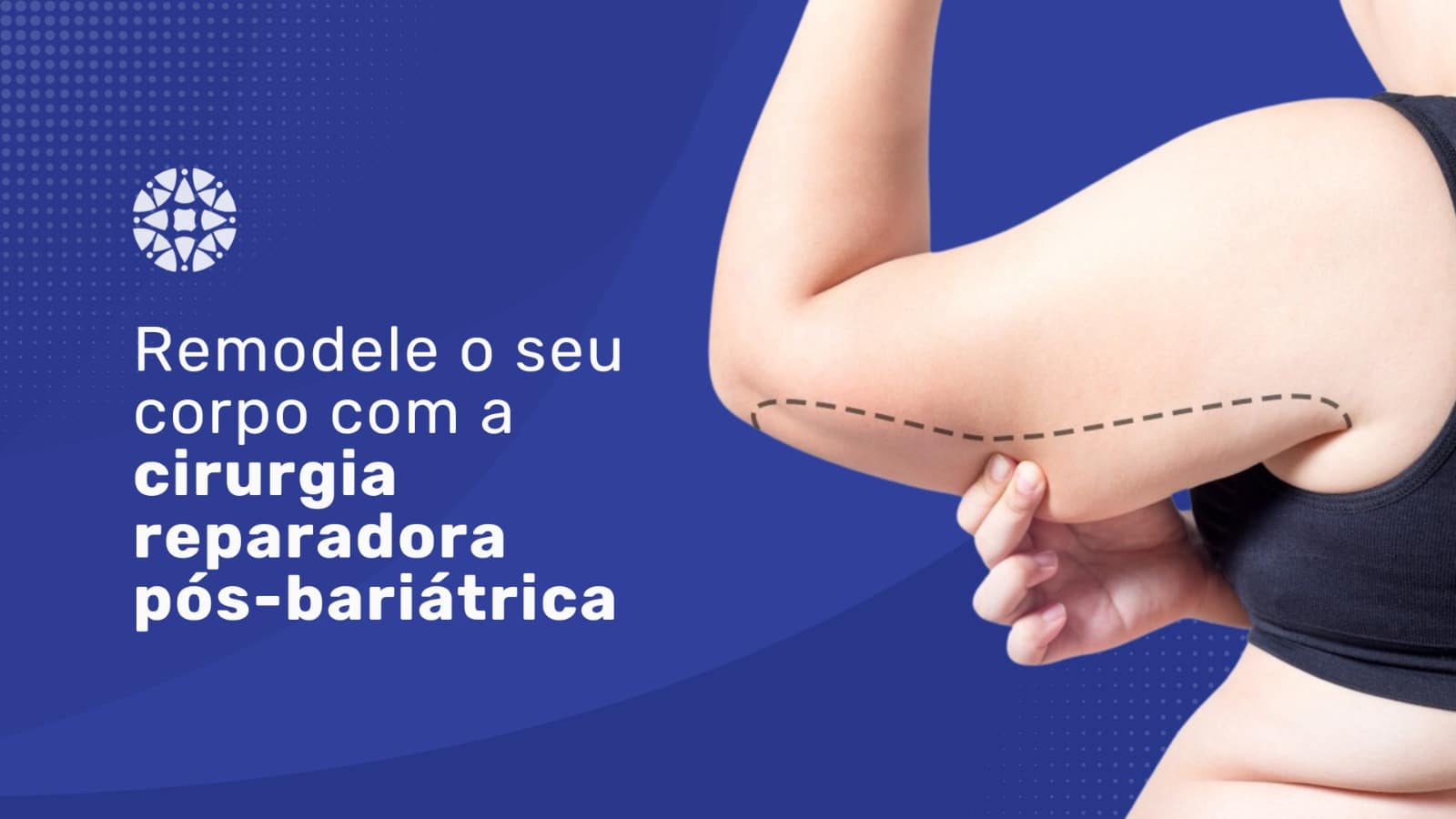 Transformação completa: cirurgia reparadora pós-bariátrica