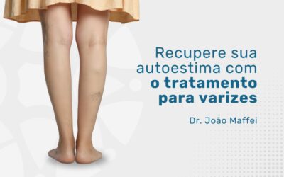 Recuperando a autoestima: tratamento para varizes