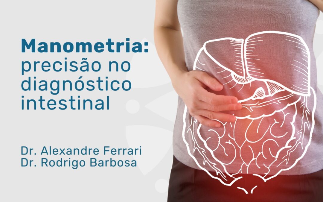 Manometria anorretal: procedimento para sua saúde intestinal