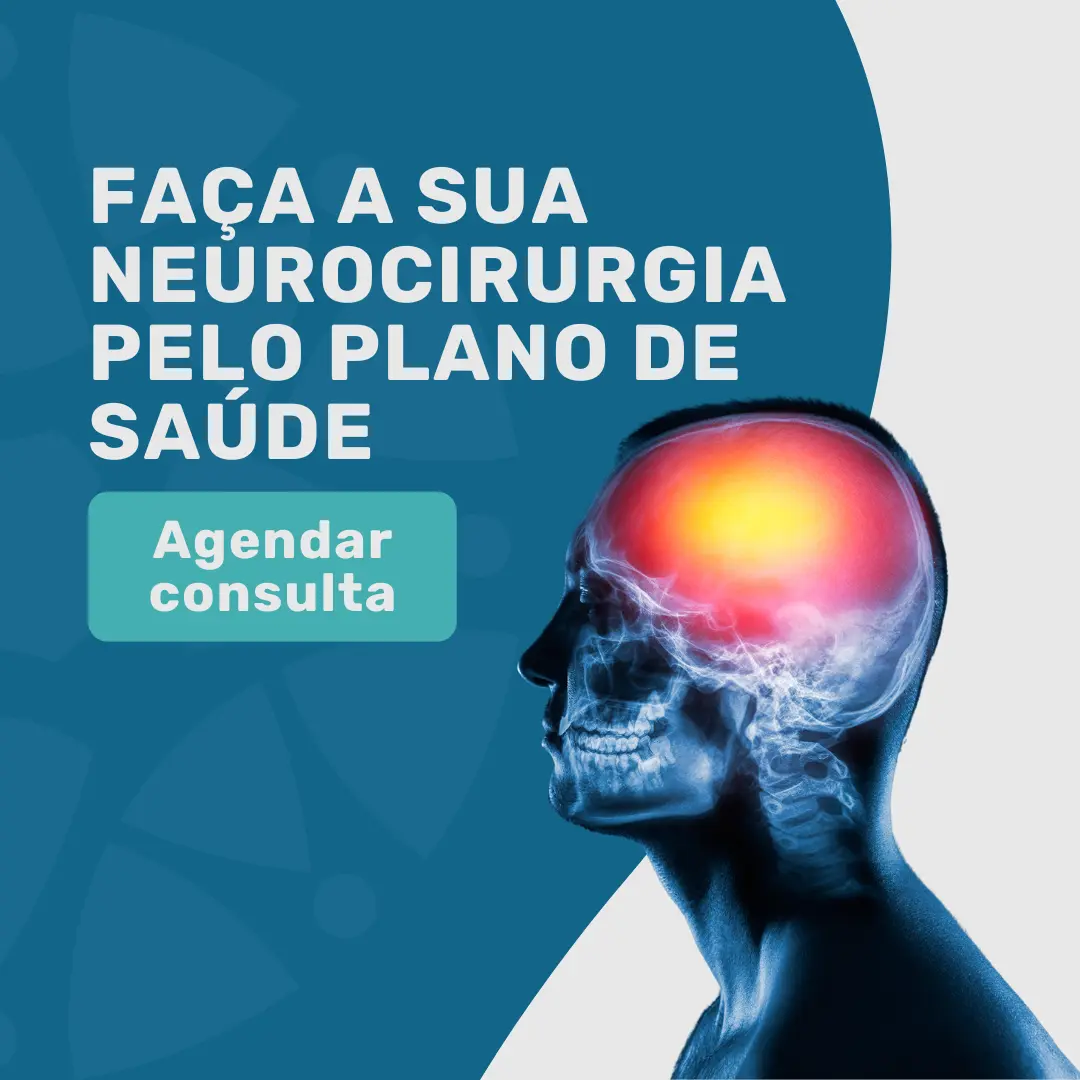 Faça a sua neurocirurgia com um neurocirurgião pelo convênio bradesco na medicina em foco