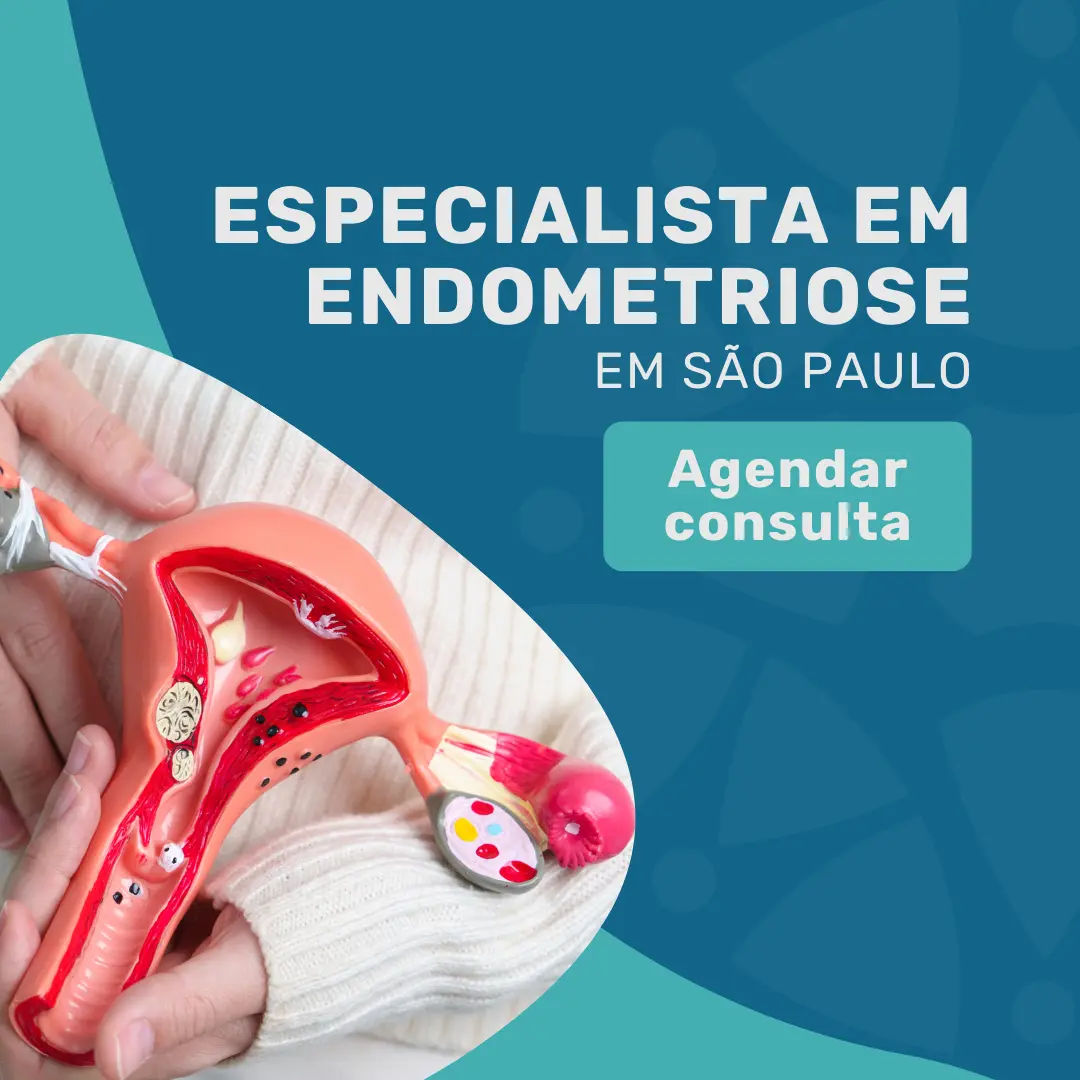 O seu Especialista em Endometriose pelo Omint Saúde na Medicina em Foco