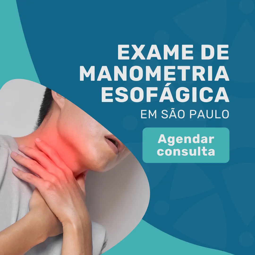 Exame de manometria esofágica na Medicina em Foco em São Paulo