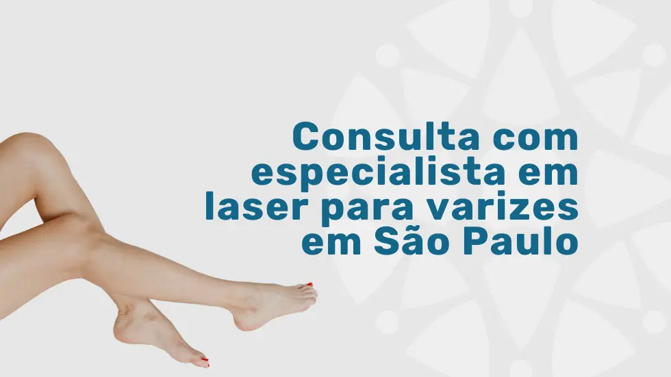 Consulta com especialista em laser para varizes em São Paulo