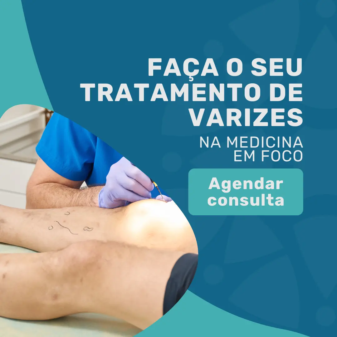 Realize o seu tratamento de varizes com um angiologista na MEF, com oDr. João Maffei