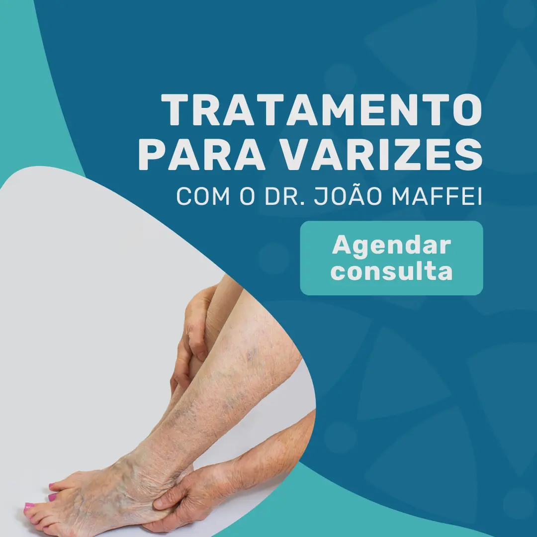 Realize o seu tratamento para varizes com um especialista em varizes Dr. Joao Maffei na Medicina em Foco