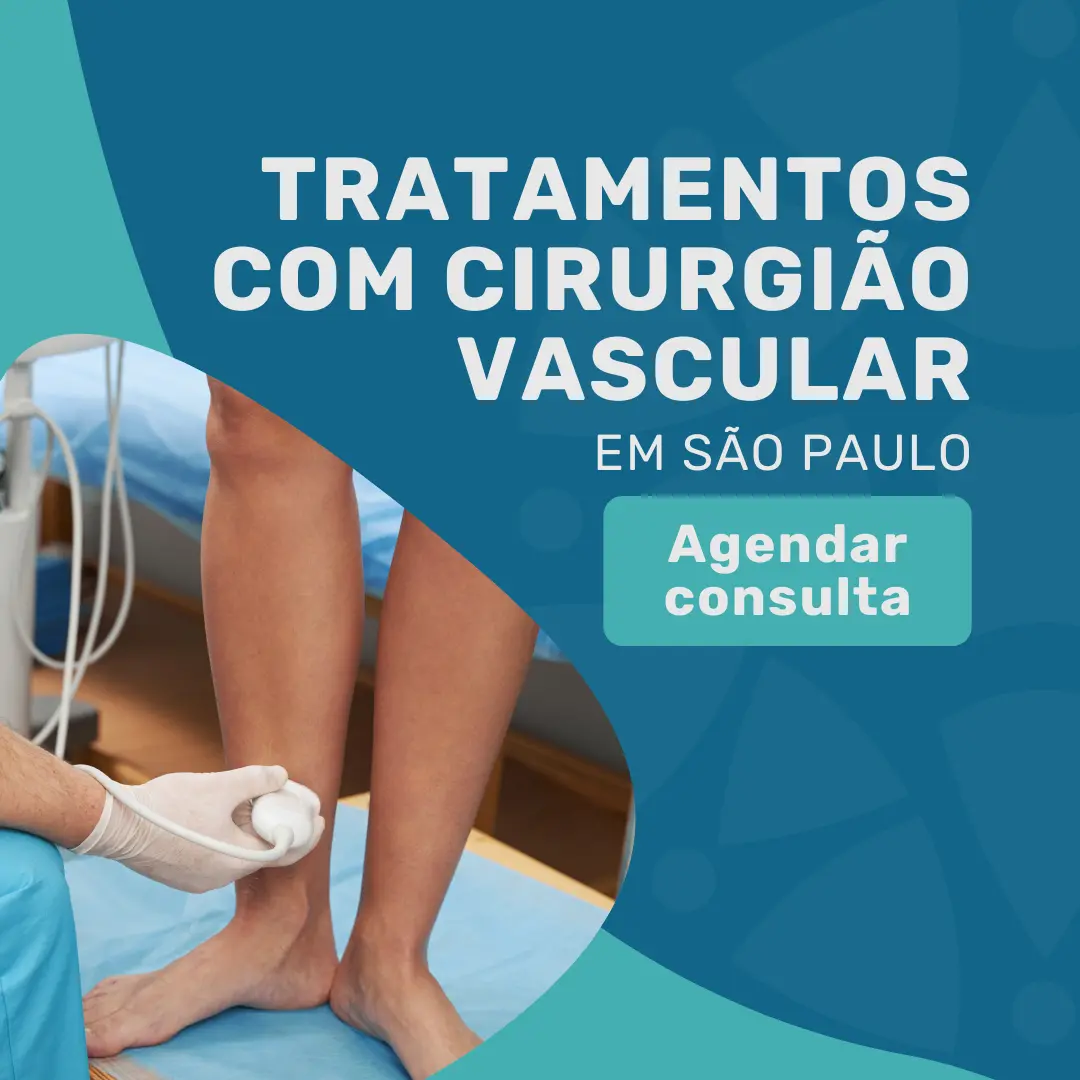 Realize o seu tratamento vascular com um cirurgião vascular em São Paulo, Dr. João Maffei