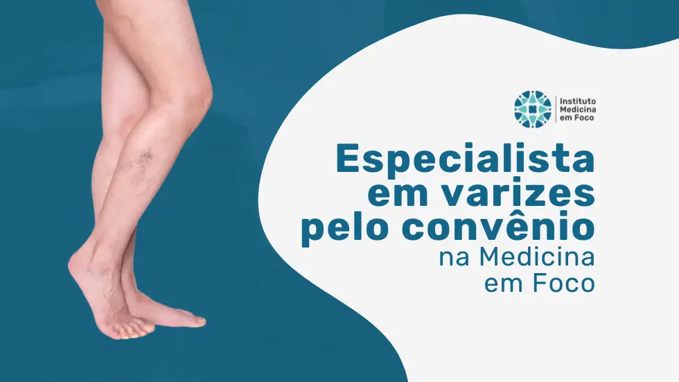 Especialista em varizes pela Omint Saúde na MEF