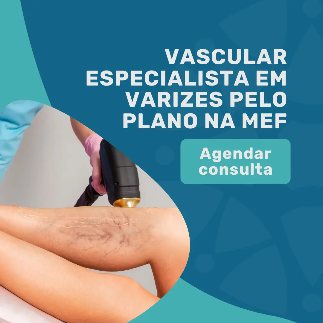 Consulta vascular com especialista em varizes, Dr. João Maffei