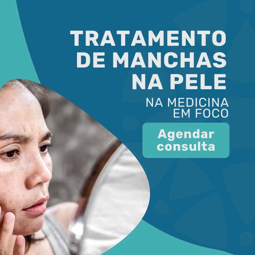 Descubra as principais causas de manchas na pele com o Dermatologista da MEF