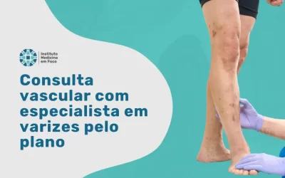 Consulta vascular com especialista em varizes pela Omint