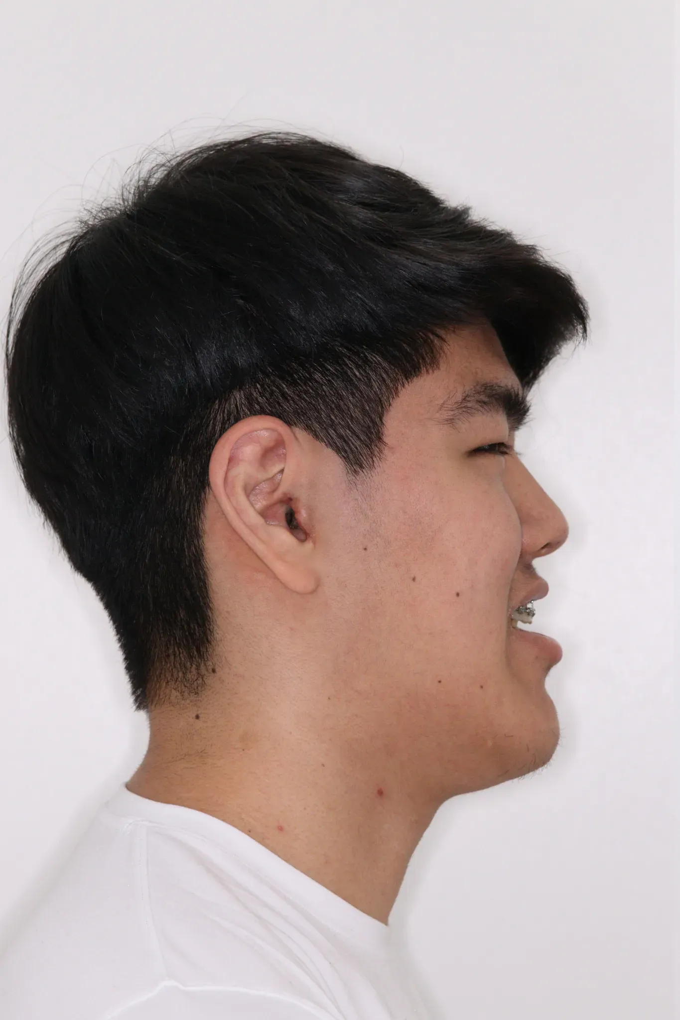 lucas depois1 webp