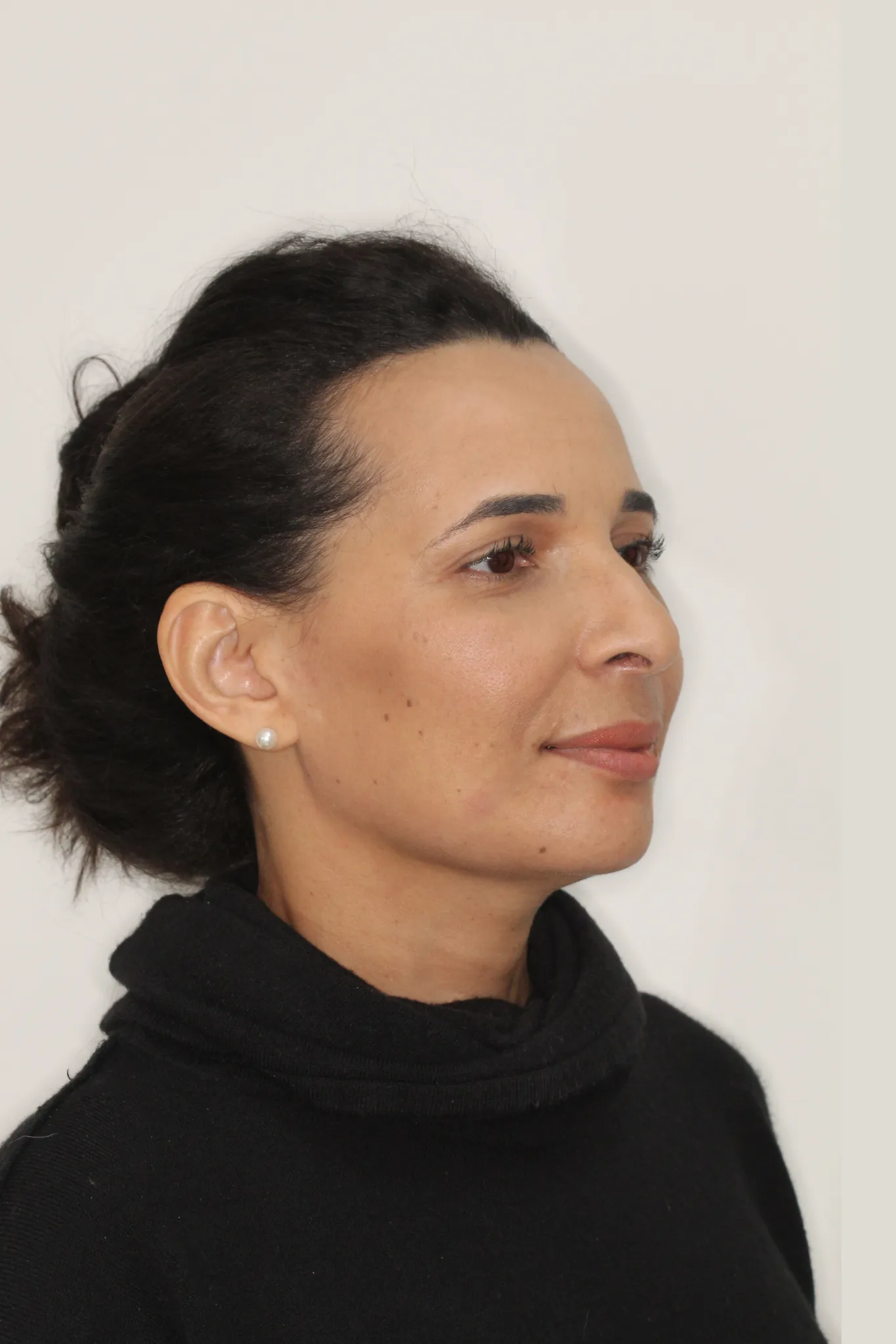 severina depois webp