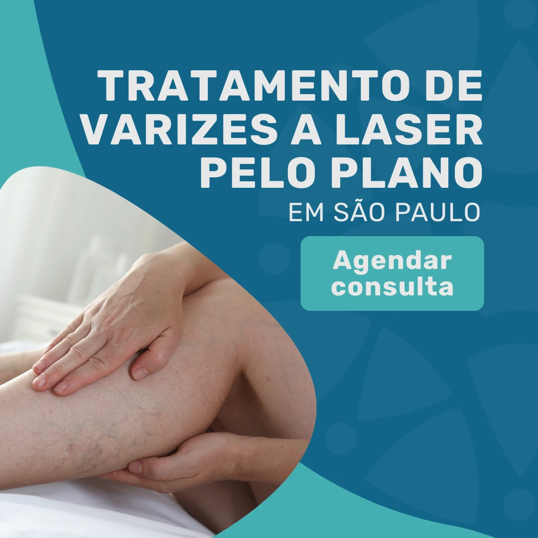 Entre em contato com o Instituto Medicina em foco para agendar uma com cirurgião vascular para o tratamento a laser para varizes Allianz