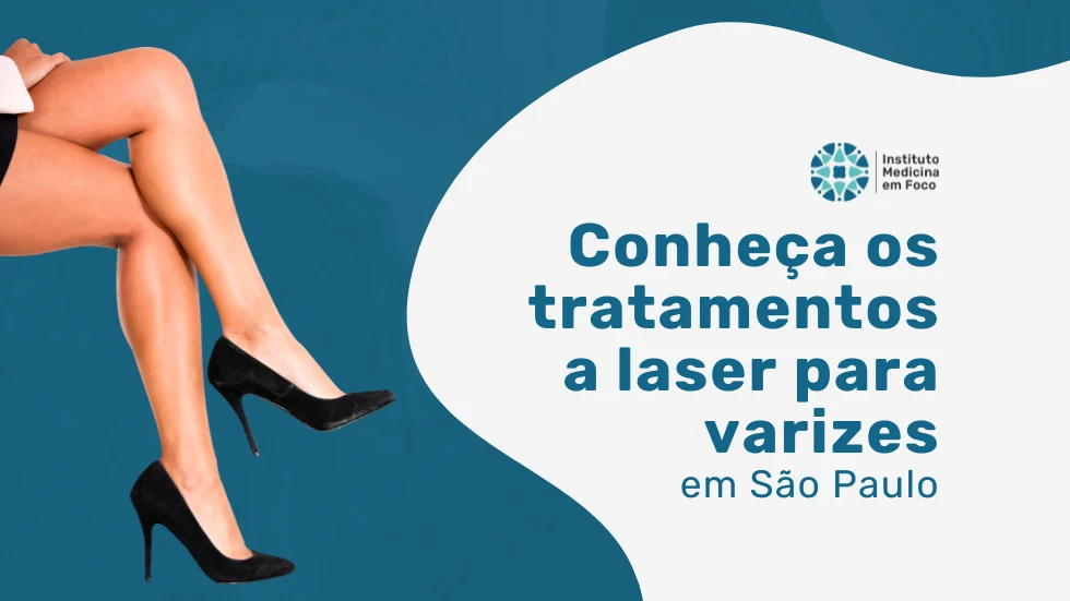 Conheça o tratamento a laser para varizes Allianz