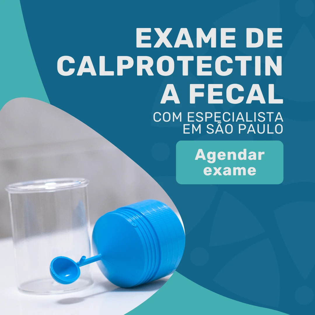 Entre em contato com o Instituto Medicina em foco para agendar exame de Calprotectina fecal em são paulo