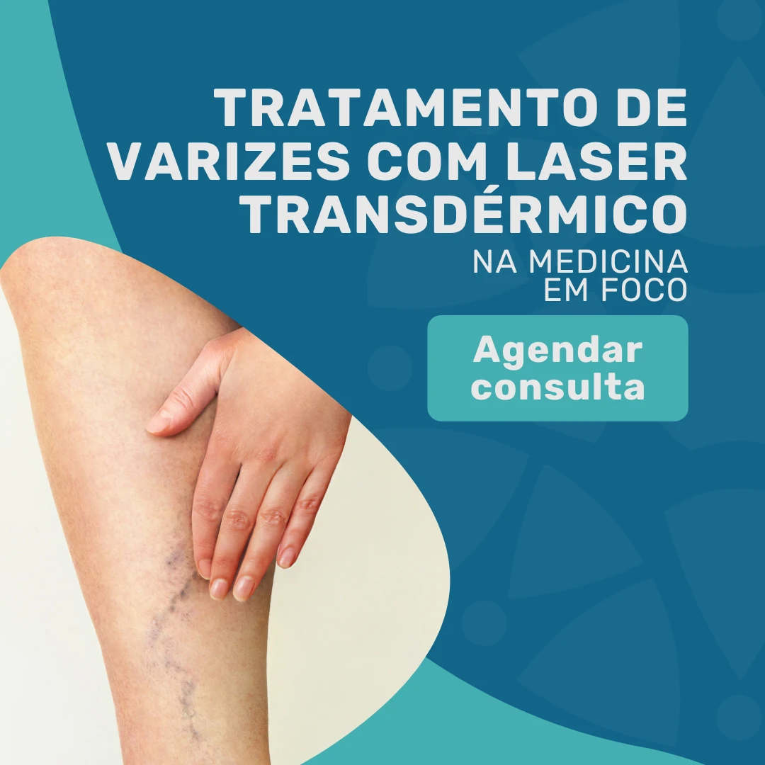 Entre em contato com o Instituto Medicina em foco para agendar seu tratamento de varizes com Laser transdérmico