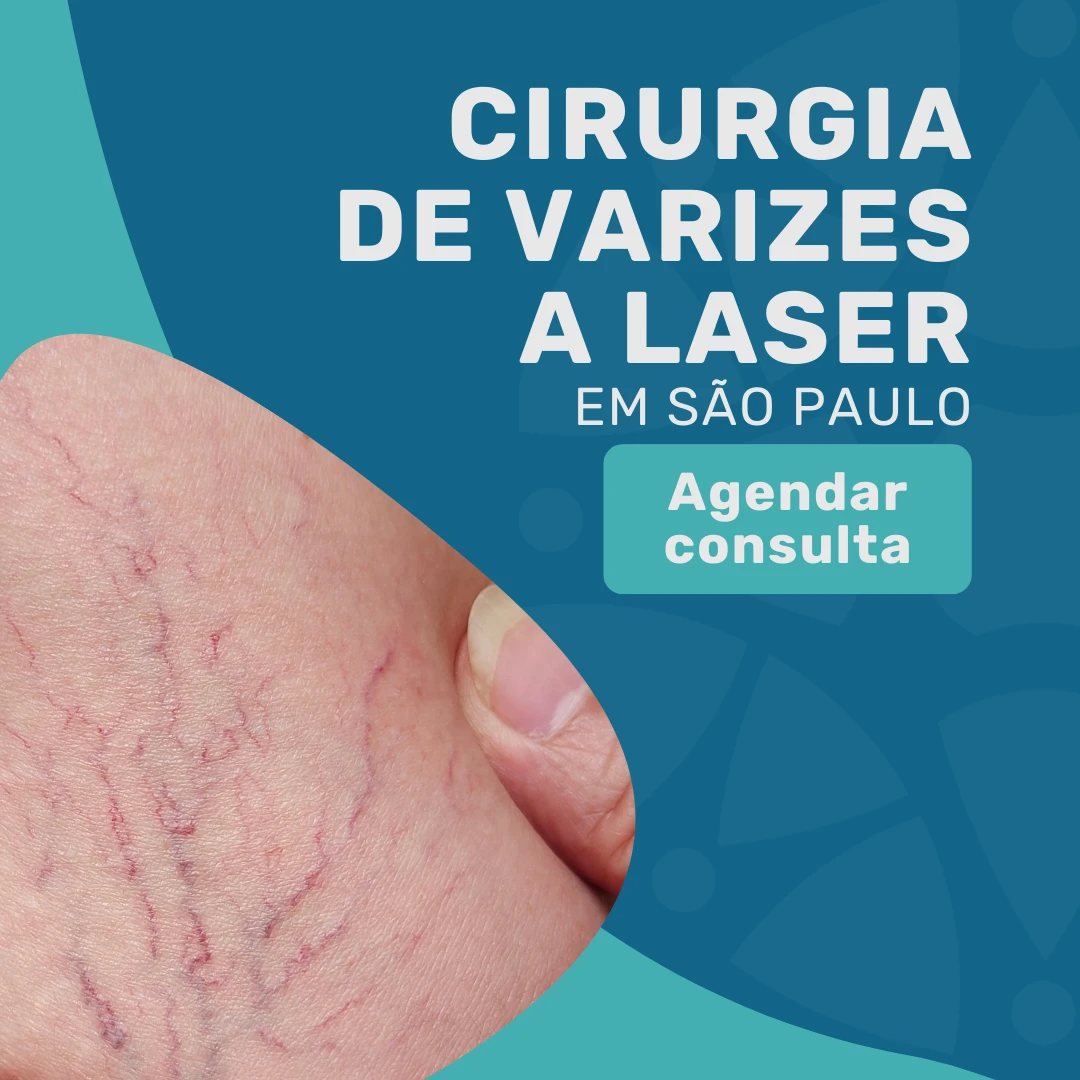 Entre em contato com o Instituto Medicina em foco para agendar sua Cirurgia de varizes a laser em são paulo