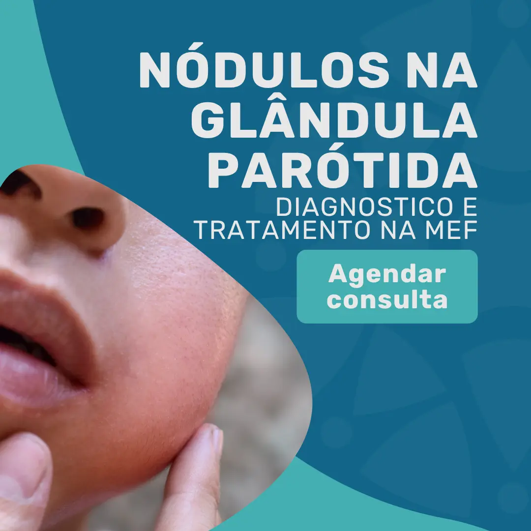 Entre em contato com o Instituto Medicina em foco para agendar sua consulta com seu cirurgião de cabeça e pescoço em são paulo para saber mais sobre nódulos na Glândula parótida