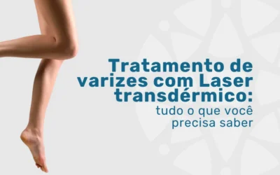Laser transdérmico: como tratar suas varizes em São Paulo?