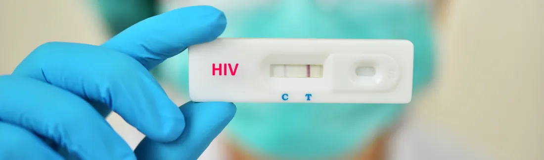 Teste rapido HIV desktop 1 webp
