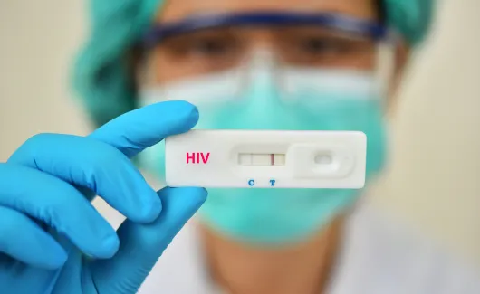 Teste rapido HIV mobile 1 webp