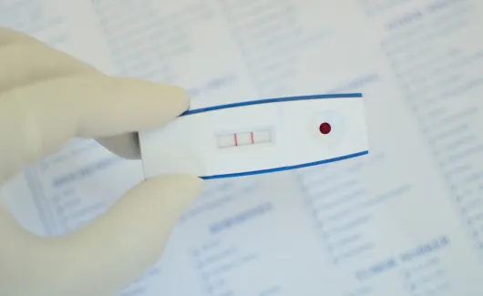 Teste rapido HIV mobile 2 webp