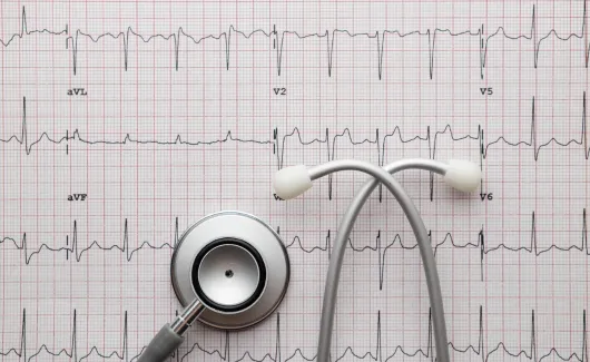 eletrocardiograma mobile 1
