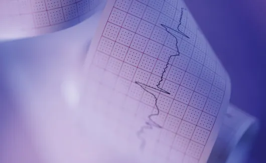 eletrocardiograma mobile 2