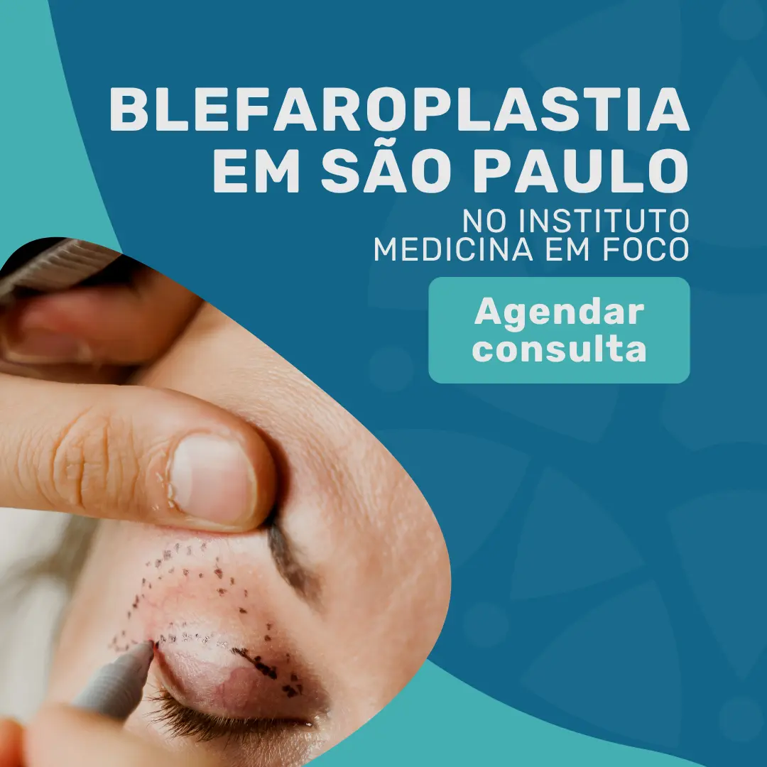 Entre em contato com o Instituto Medicina em foco para agendar sua consulta com cirurgião plástico e realizar uma Blefaroplastia em são paulo