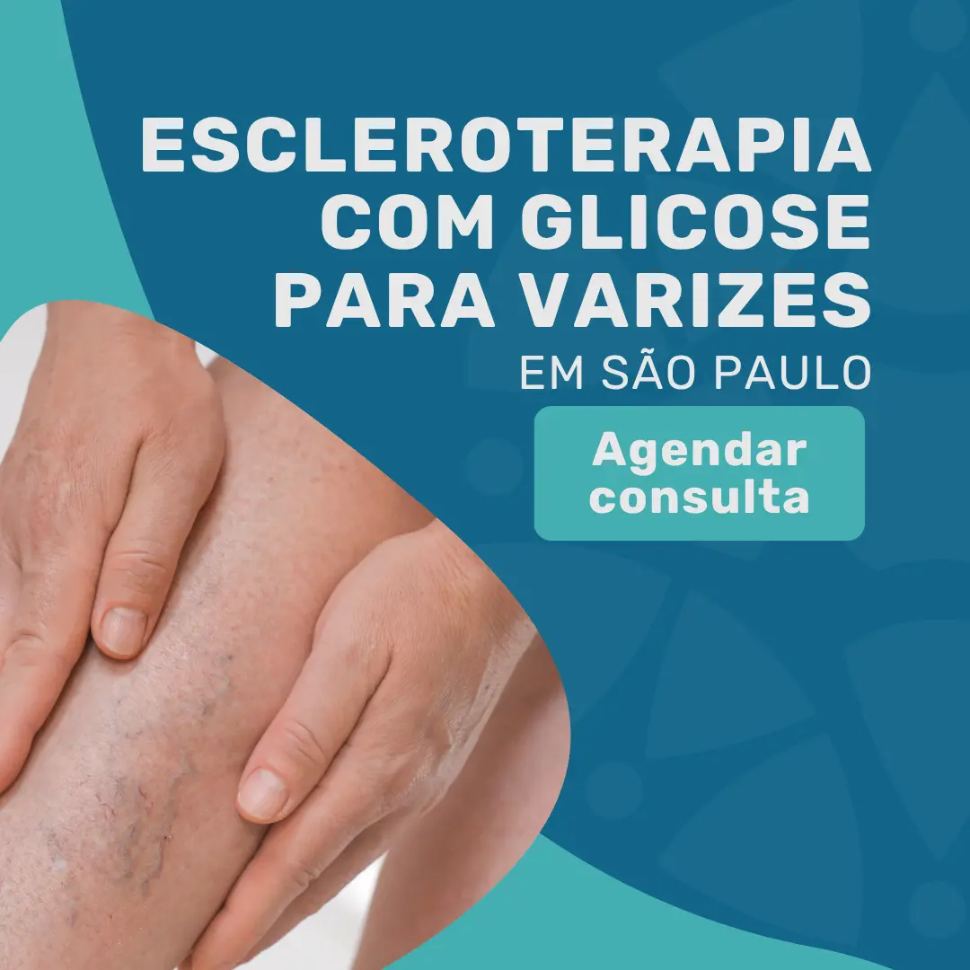 Entre em contato com o Instituto Medicina em foco para saber mais sobre o tratamento Escleroterapia com glicose com Cirurgião Vascular especialista em varizes em são paulo