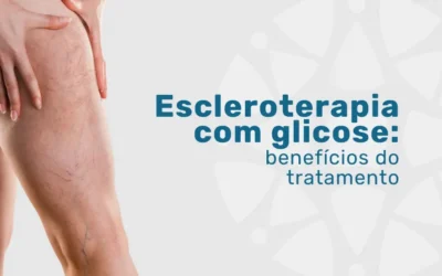 Escleroterapia com glicose: benefícios do tratamento