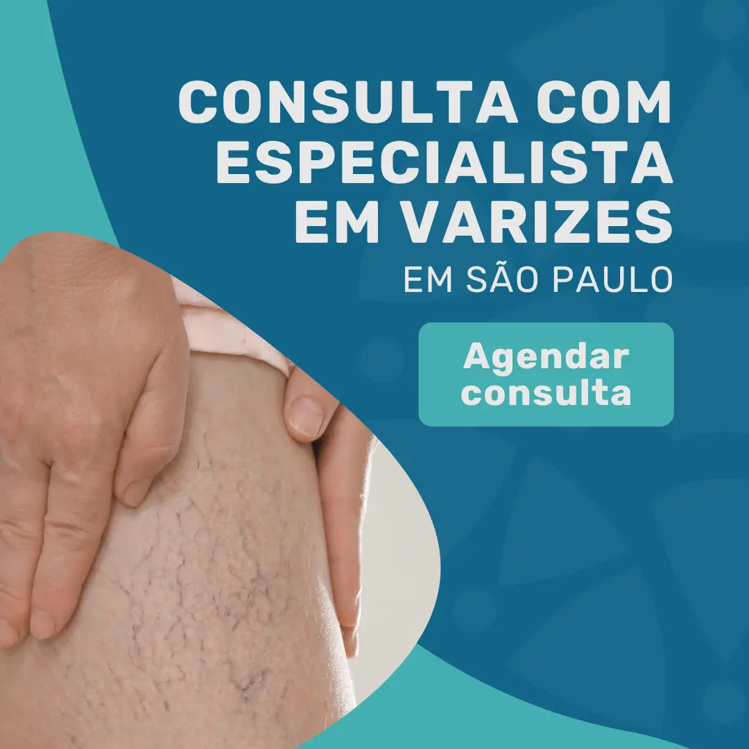 Entre em contato com o Instituto Medicina em foco para Consulta com angiologista especialista em varizes em São Paulo