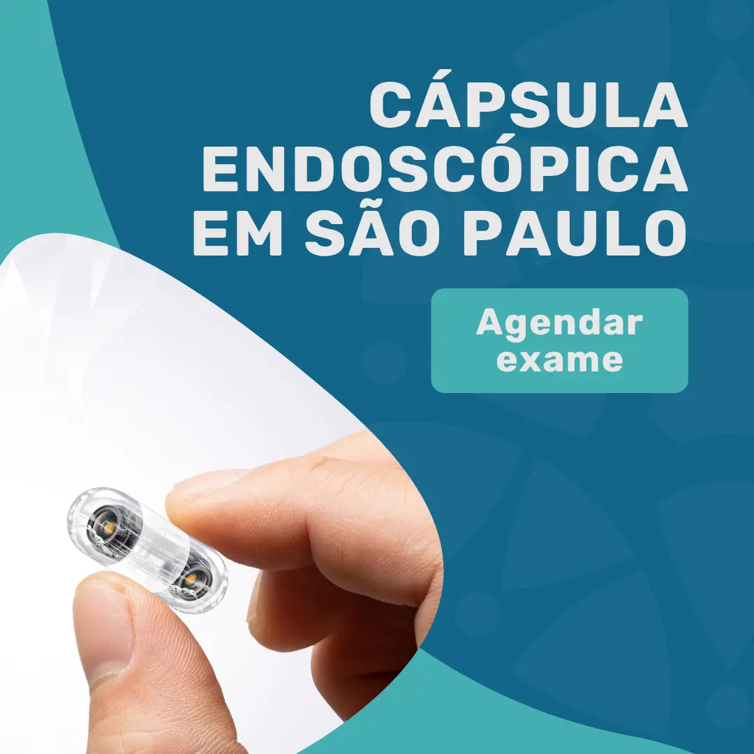Entre em contato com o Instituto Medicina em foco para agendar o seu exame de cápsula endoscópica em São Paulo