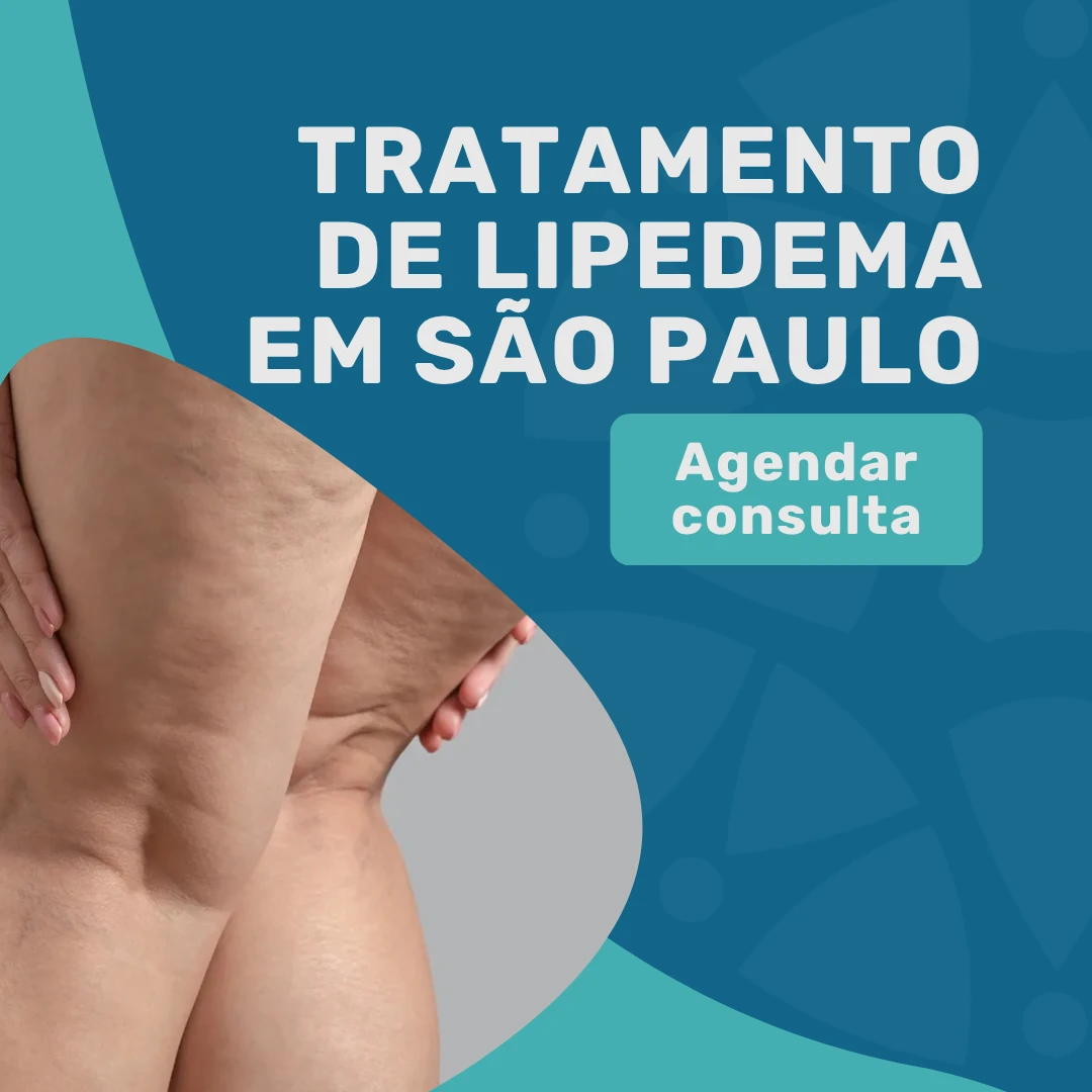 Entre em contato com o Instituto Medicina em foco para agendar uma consulta com angiologista em são paulo para o tratamento de lipedema