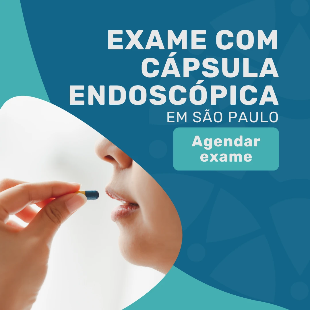 Entre em contato com o Instituto Medicina em foco para realizar Exame com cápsula endoscópica em são paulo