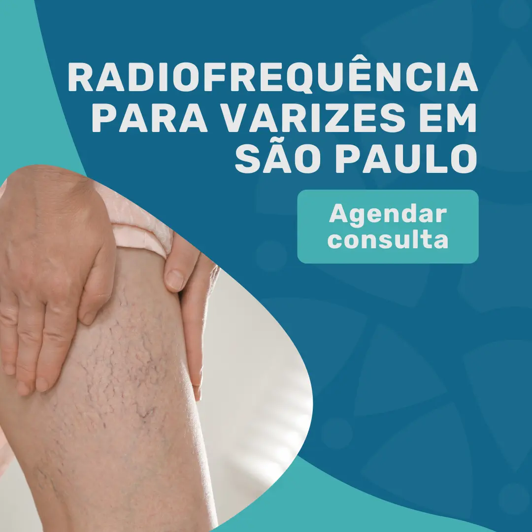 Entre em contato com o Instituto Medicina em foco para realizar a sua RADIOFREQUÊNCIA PARA VARIZES EM SÃO PAULO com cirurgião vascular especialista em varizes
