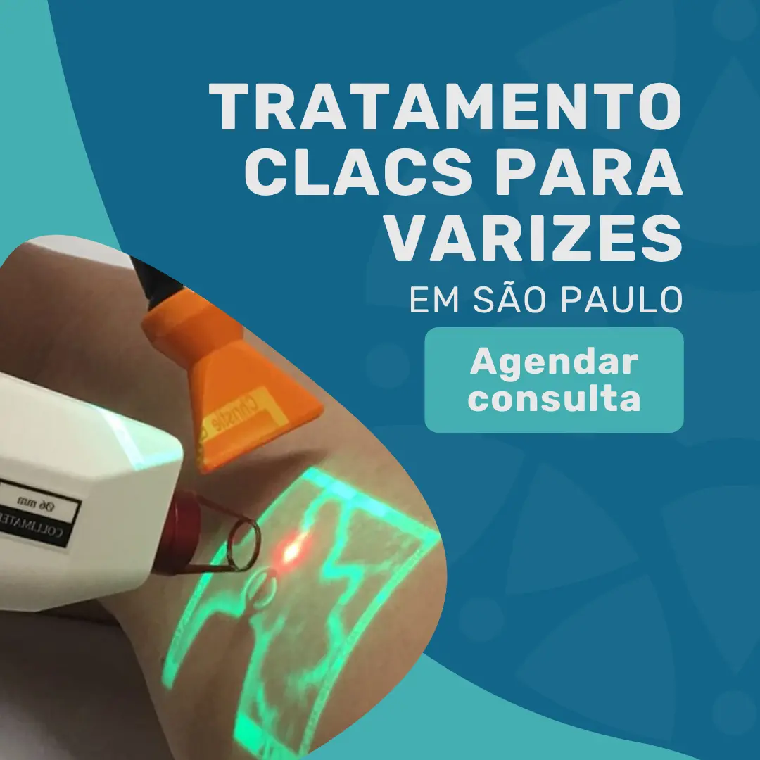 Entre em contato com o Instituto Medicina em foco para realizar o seu tratamento clacs para varizes em São Paulo