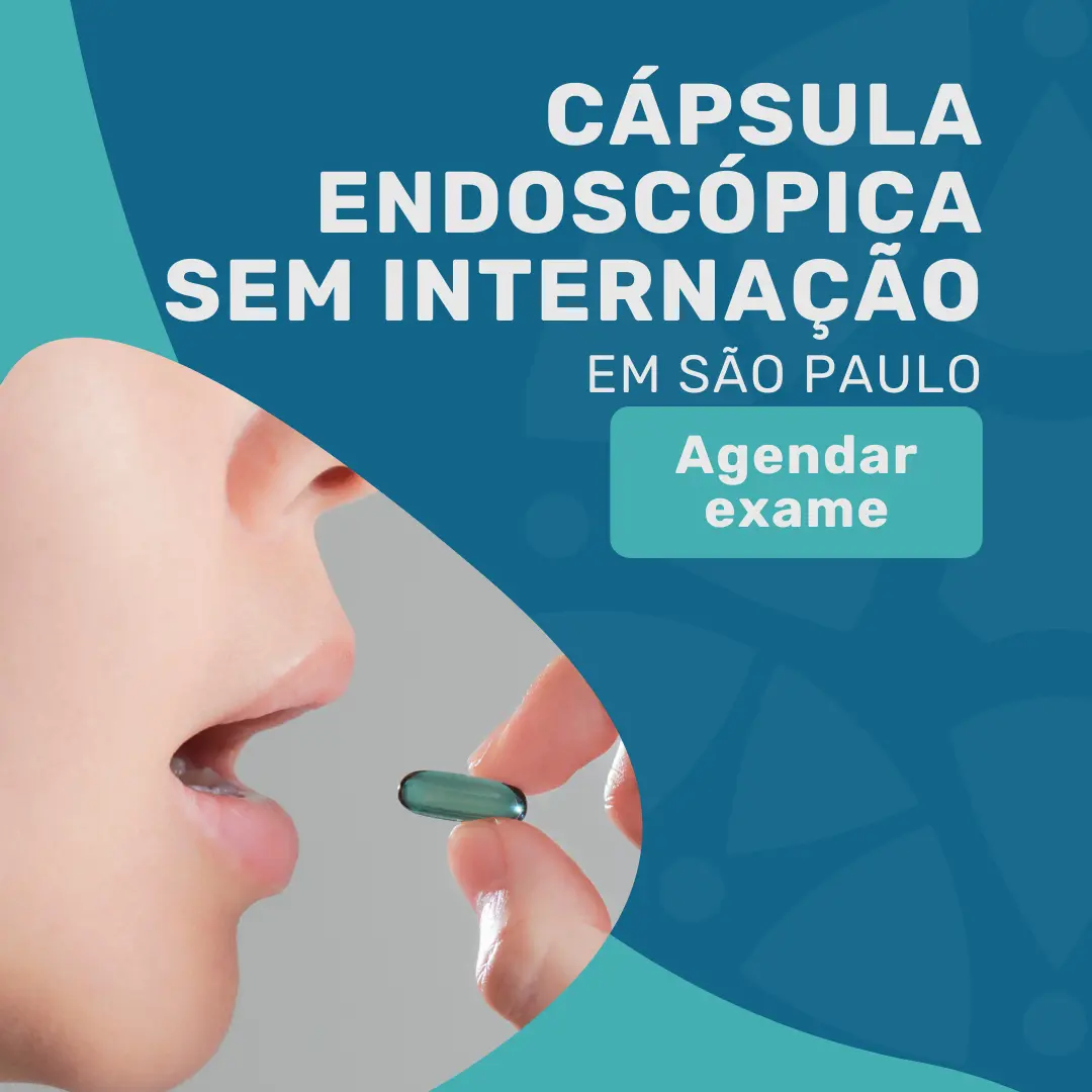 Entre em contato com o Instituto Medicina em foco para saber sobre valor da cápsula endoscópica em São Paulo