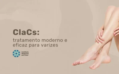 ClaCs: tratamento moderno e eficaz para varizes