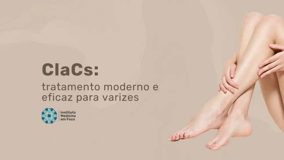 ClaCs: tratamento moderno e eficaz para varizes